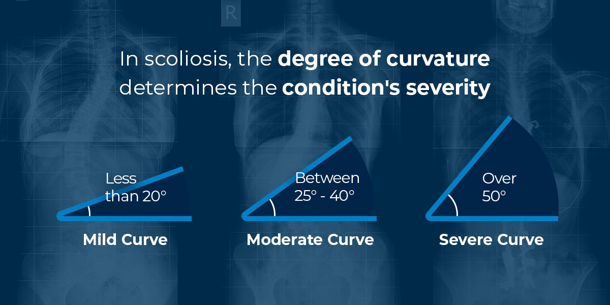 How Much Curve Should Your Back Have?