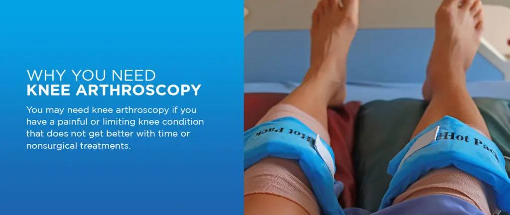 Do You Have to Wear a Brace After Arthroscopic Knee Surgery?