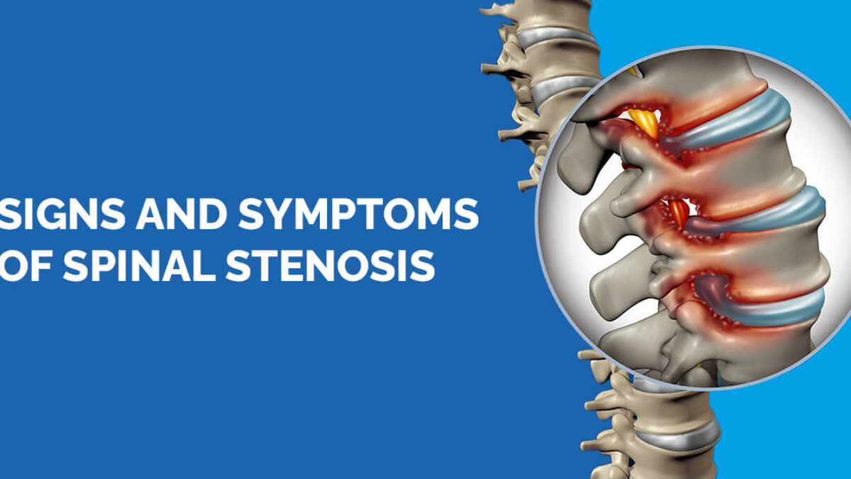 Spinal Stenosis  Neurological Surgery