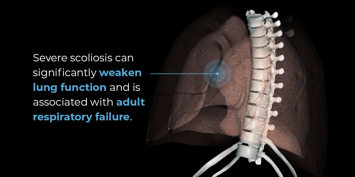 Lungs