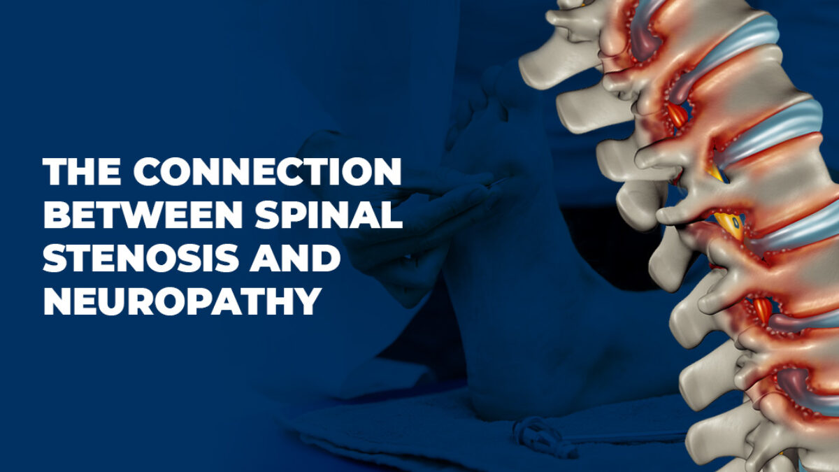 Spinal Stenosis and Neuropathy Connection