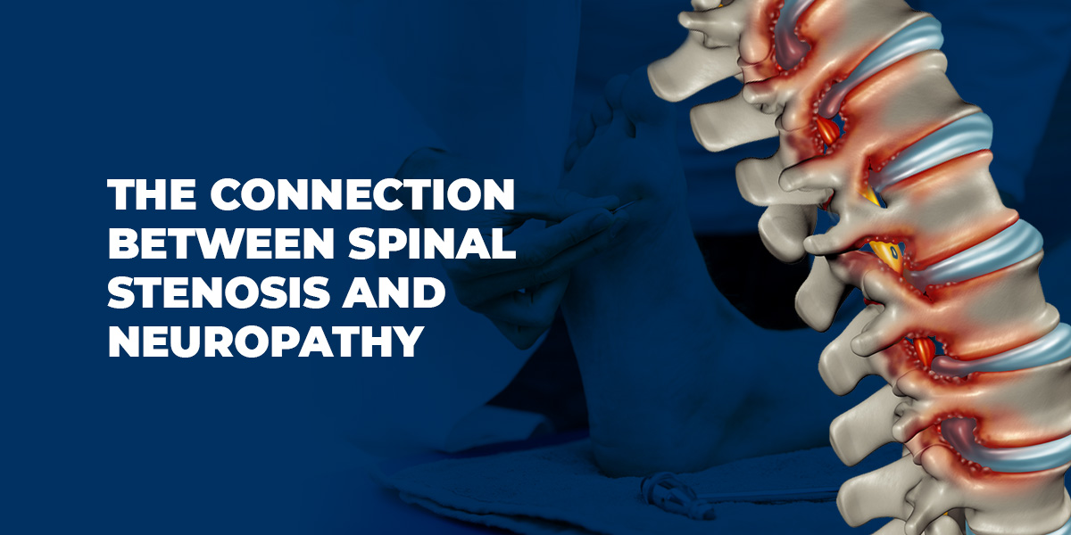 Spinal Stenosis and Neuropathy Connection