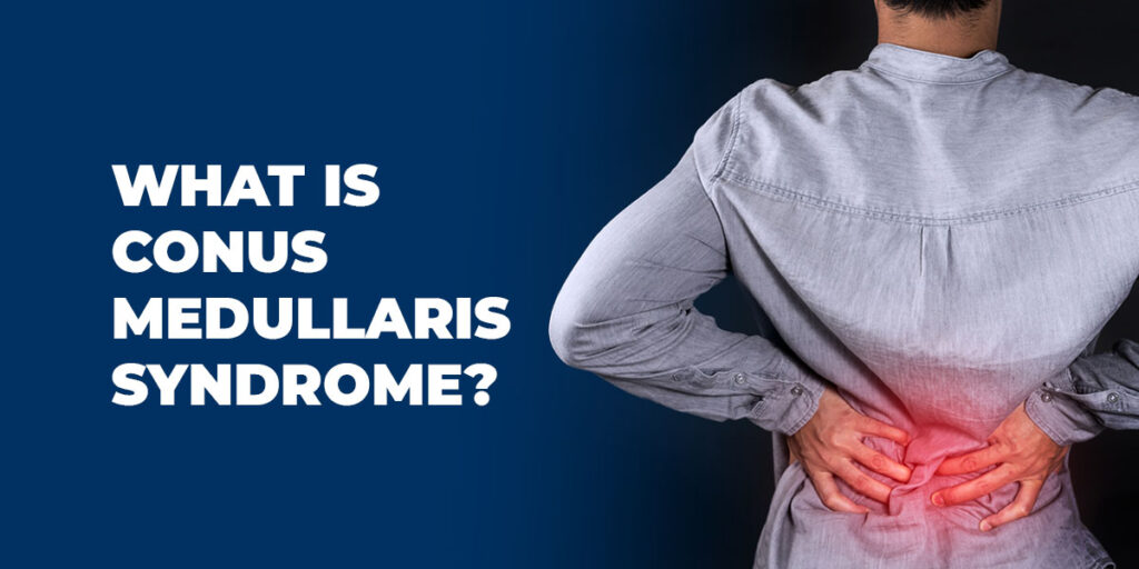 What is Conus Medullaris Syndrome? | New York Spine Institute