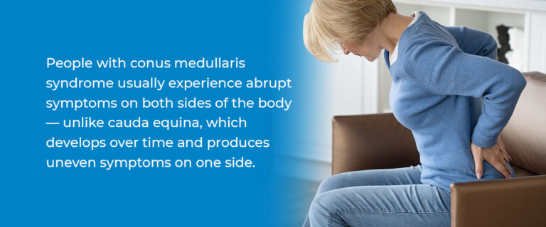 What Is Conus Medullaris Syndrome New York Spine Institute