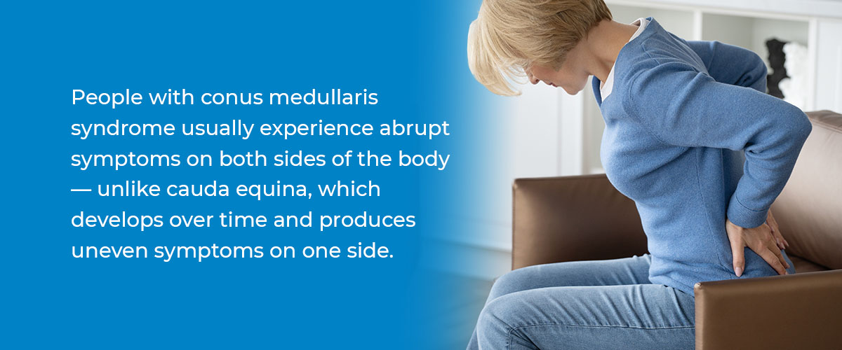 What is Conus Medullaris Syndrome? | New York Spine Institute